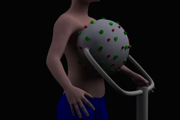 Detecting breast cancer using 3D photography