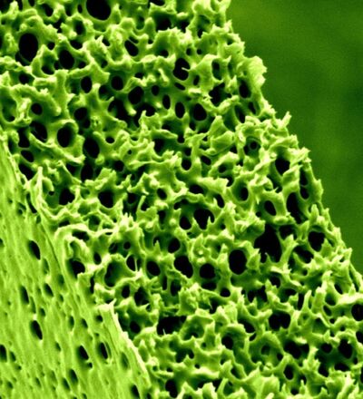 Dwarsdoorsnede van een polymeermembraan met holle vezels. Groen: polymeer; zwart: poriën.