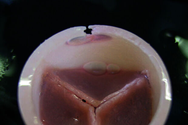 Growing artificial heart valve may be reality