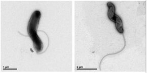 Bacterie M. promoryiensis onder de elektronenmicroscoop. Bron | Dylan Atkins Bacterie M. promoryiensis onder de elektronenmicroscoop. Bron | Dylan Atkins