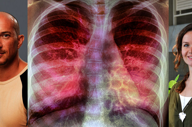 Key hurdle in development drug against cystic fibrosis