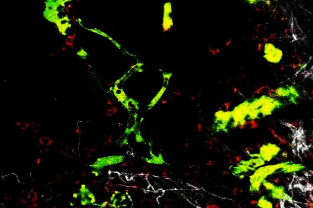 Study on trained immunity to fight cancer