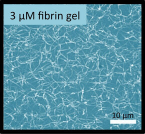 Biopolymeer-netwerken (cellulose en fibrine).