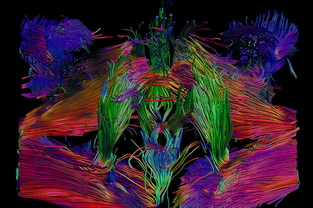 Insight in muscle damage