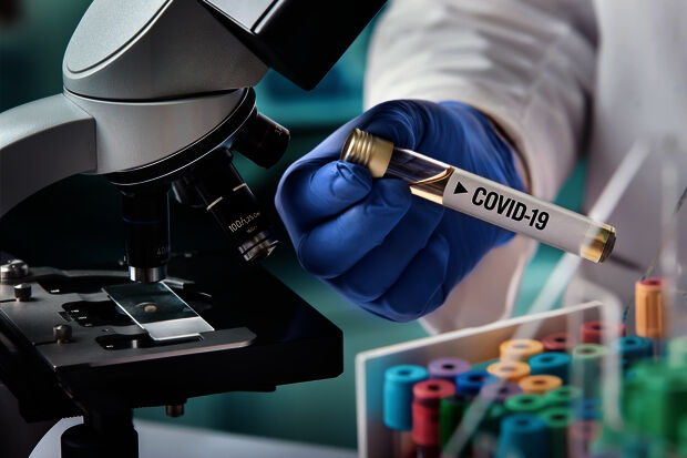 “We should now quickly scale up the number of tests”