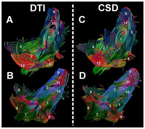 DTI/CSD-image pelvic floor