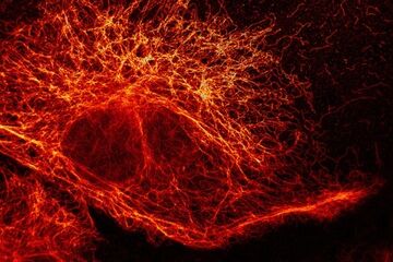 Photograph: Stefan W Hell/Division of Optical Nanoscopy/German Cancer Research Center