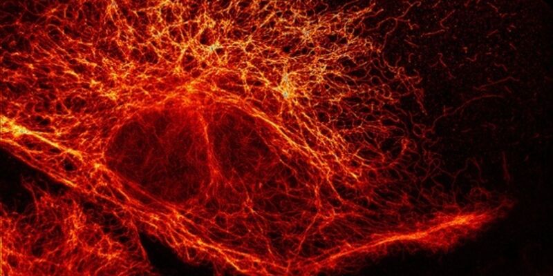 Photograph: Stefan W Hell/Division of Optical Nanoscopy/German Cancer Research Center