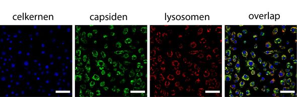 ONDER DE MICROSCOOP IS TE ZIEN DAT DE VIRUSMANTELS (CAPSIDEN) GEVULD MET MEDICIJN OP DE GEWENSTE PLEK IN DE CEL - DE LYSOSOMEN - TERECHTKOMEN. AFBEELDING | DAAN VERVOORT