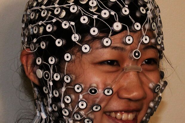Targeting epilepsy more gentle with electrodes on the head